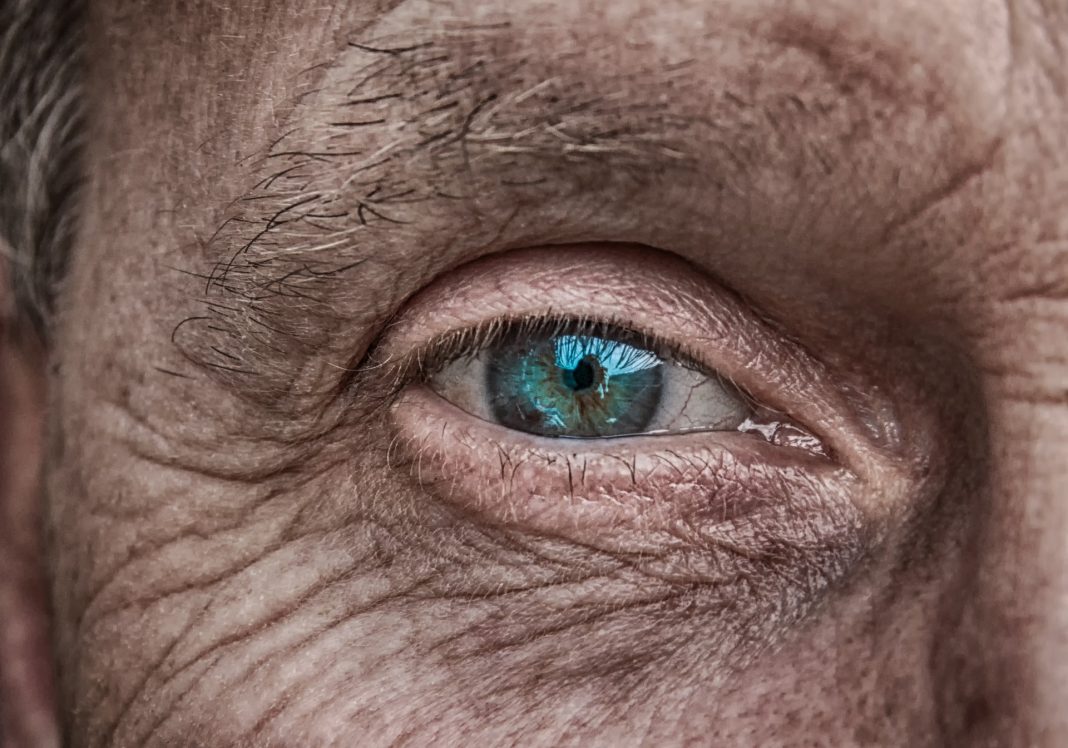 Grauer Star - eine Beeinträchtigung der Augen, die inzwischen auch mit einer Operation behoben werden kann. Bildquelle: Pixabay.de