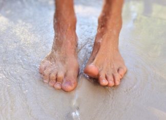 Hallux Valgus: Diagnose und Behandlung des Überbeins Hallux Valgus tritt in den meisten Fällen bei Frauen auf. Bildquelle: Pixabay.de