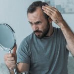 Haarausfall bei Männern und Frauen kann ganz unterschiedliche Ursachen haben. Bildquelle: canva