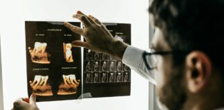 Warum sind Zahnimplantate in der Türkei billiger? Zahnimplantate sind modernster Zahnersatz, aber auch entsprechend kostspielig. Bildquelle: © Jonathan Borba / Unsplash.com