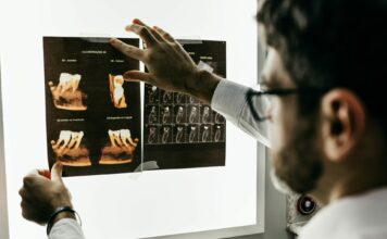 Warum sind Zahnimplantate in der Türkei billiger? Zahnimplantate sind modernster Zahnersatz, aber auch entsprechend kostspielig. Bildquelle: © Jonathan Borba / Unsplash.com