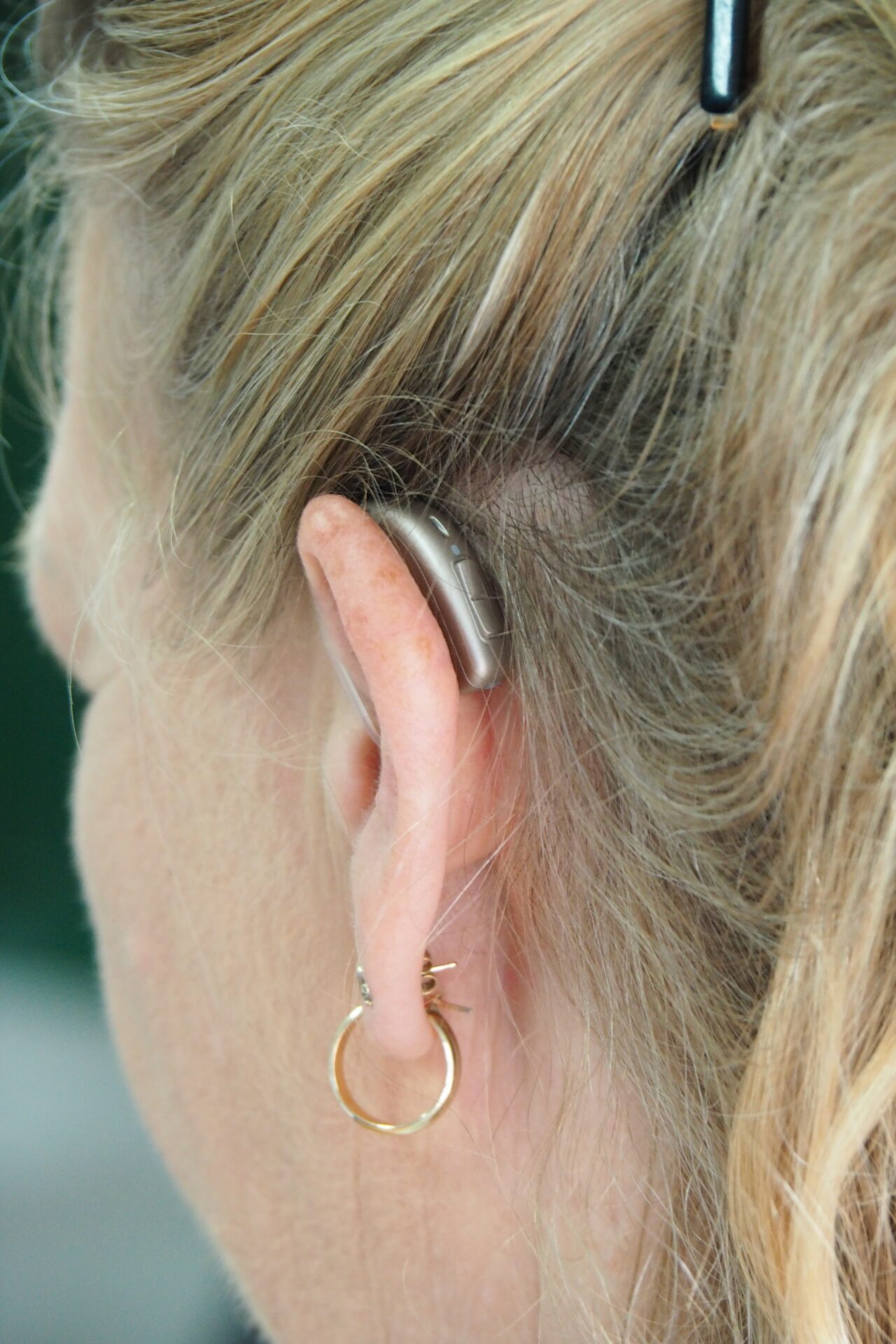 Das Hörgerät ist eine Bereichung für all diejenigen, die unter einer Beeinträchtigung des Gehörs leiden. Bildquelle: © Logan Weaver / Unsplash.com