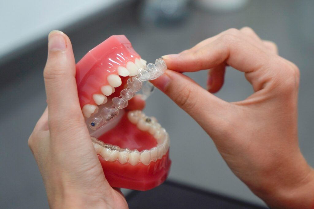 Zahn-Fehlstellungen lassen sich in den meisten Fällen inzwischen auf eine einfache und effektive Art und Weise korrigieren. Bildquelle: © Beyza Kaplan / Unsplash.com