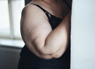 Adipositas: (K)eine Frage des Alters Erhöhtes Übergewicht oder auch Adipositas finden wir inzwischen in allen Altersschichten. Bildquelle: © Getty Images / Unsplash.com