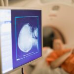 Eine MRT-Untersuchung ist inzwischen in der medizinischen Diagnostik nicht mehr weg zu denken. Bildquelle: © Getty Images / Unsplash.com